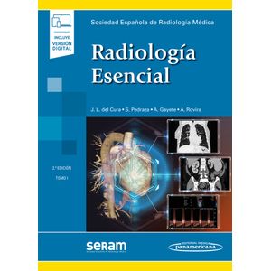 Portada del libro RADIOLOGIA ESENCIAL 2 TOMOS Autor DEL CURA RODRIGUEZ, JOSE LUIS Y OTROS