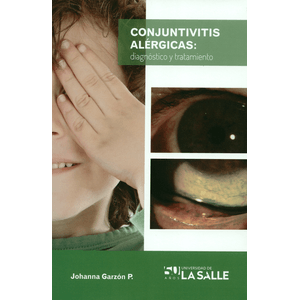 Portada del libro CONJUNTIVITIS ALERGICAS DIAGNOSTICO Y TRATAMIENTO Autor GARZON P, JOHANNA